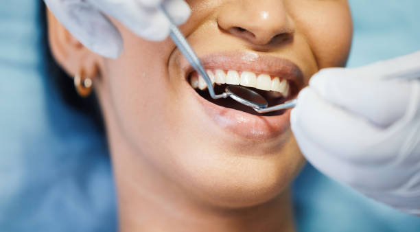 Emergency Dental Filling Replacement in NJ